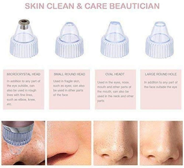 Pore Cleaning Blackhead Remover